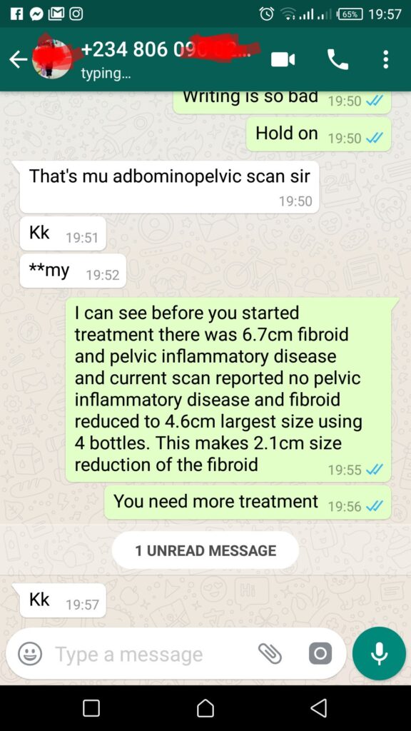 (15)Pid Cleared, Fibroid reduced 2.1cm