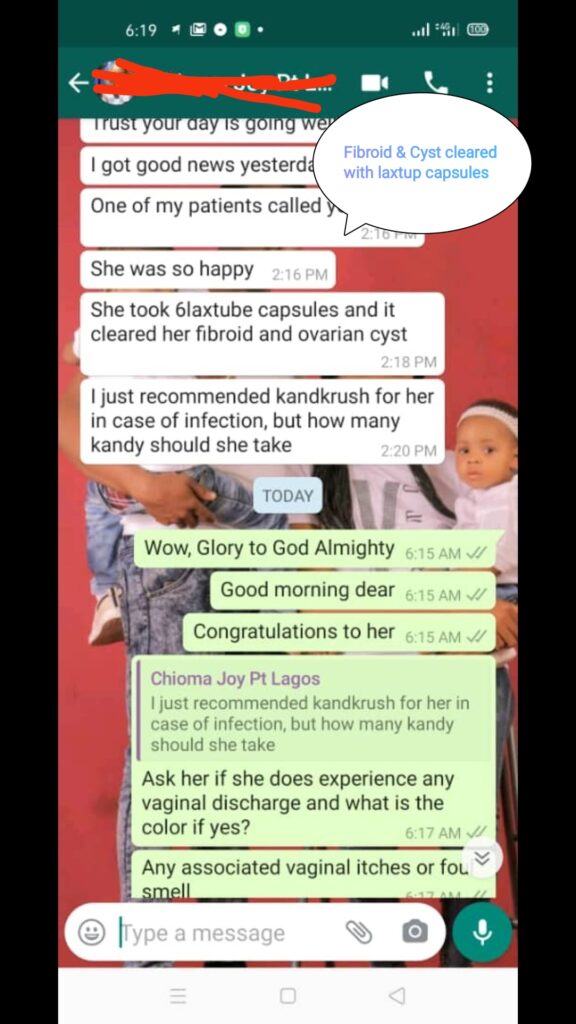 (49) fibroid _ cyst cleared