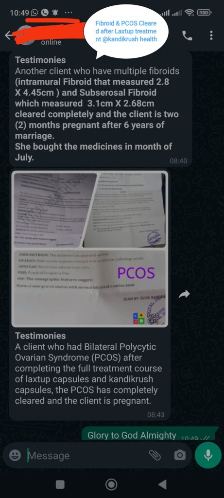 (52) Fibroid &Pcos Cleared after Laxtup treatment