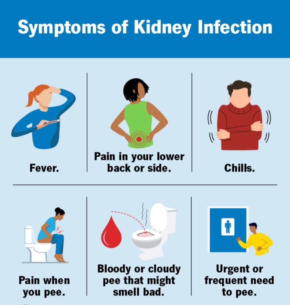 KIDNEY INFECTION :  CAUSES , SYMPTOMS & TREATMENT: